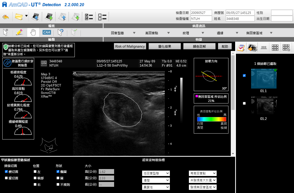 AmcAD-UT安克生醫甲狀腺超音波電腦輔助系統
